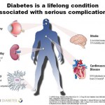How To Prevent Diabetes And Avoid Complications That Can Kill You